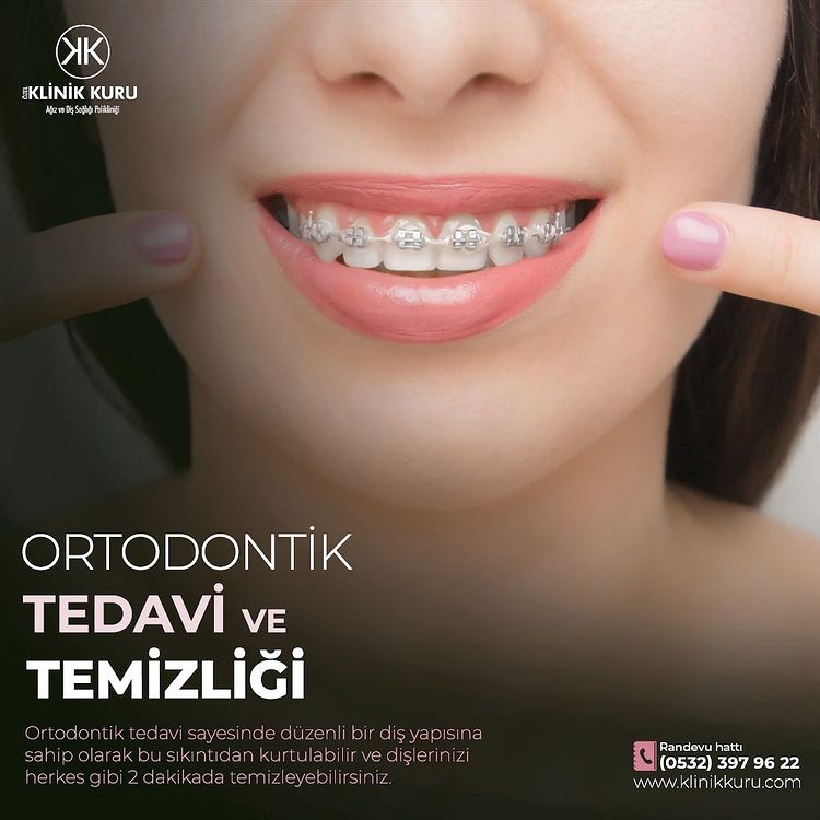 Ortodontik Tedavi ve Temizliği